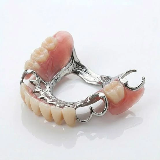 Dentier partiel en stellite : un châssis métallique avec ses crochets, et des dents sur une base rose