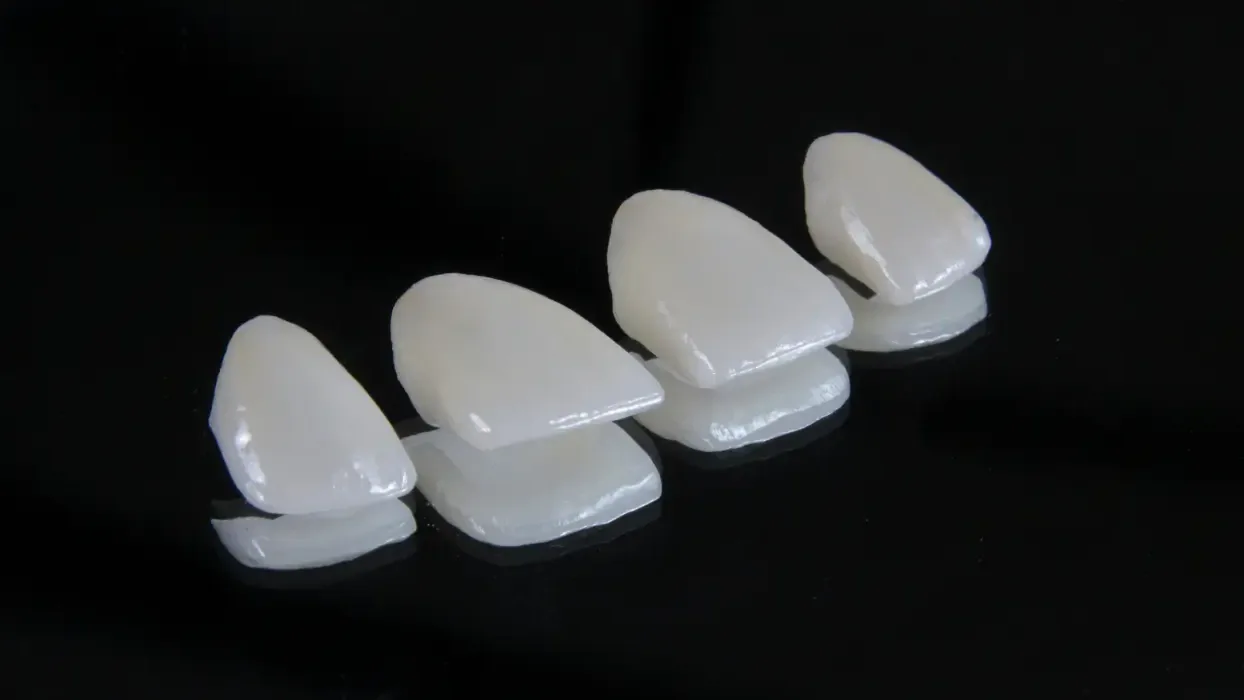 Quatre facettes dentaires en céramique sur un fond noir
