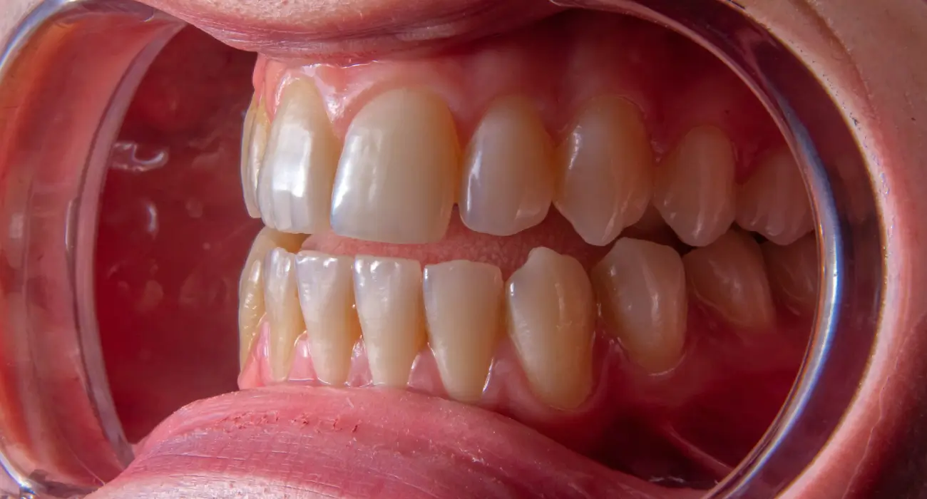 Examen clinique des gencives et des tissus parodontaux au Centre Dentaire Kandil à Mohammedia.