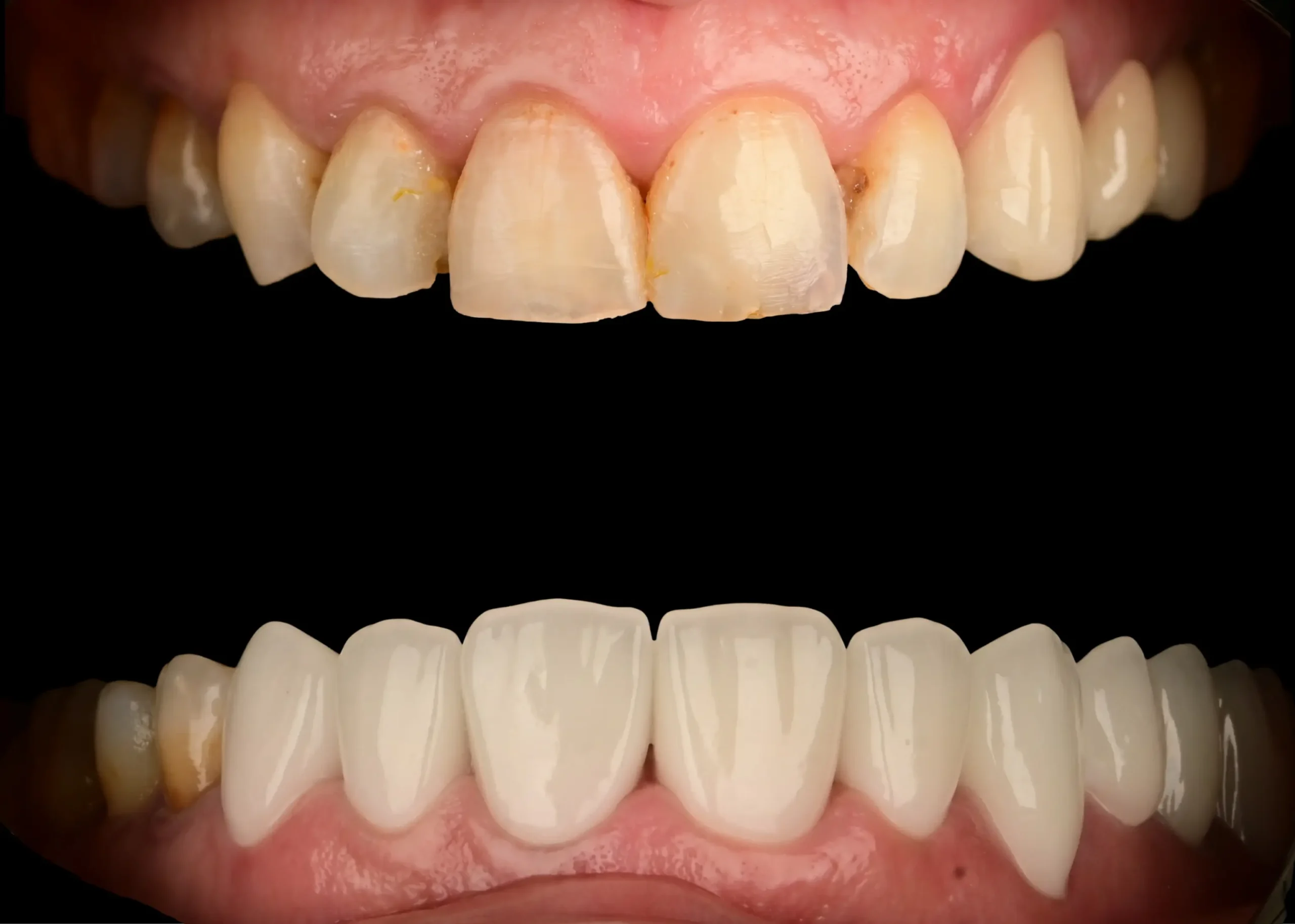 cas esthetique realisé par dr sami kandil au centre dentaire kandil mohammedia