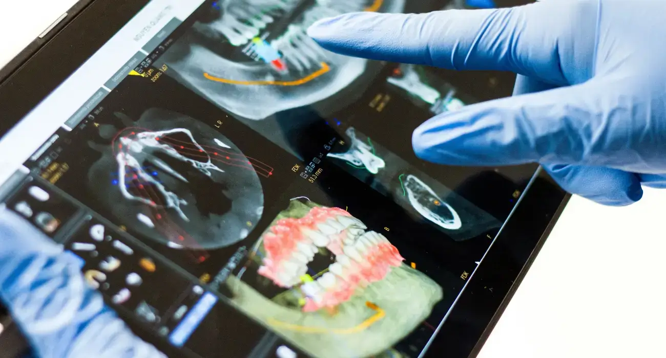 Examen clinique avant la pose d’un implant dentaire au Centre Dentaire Kandil