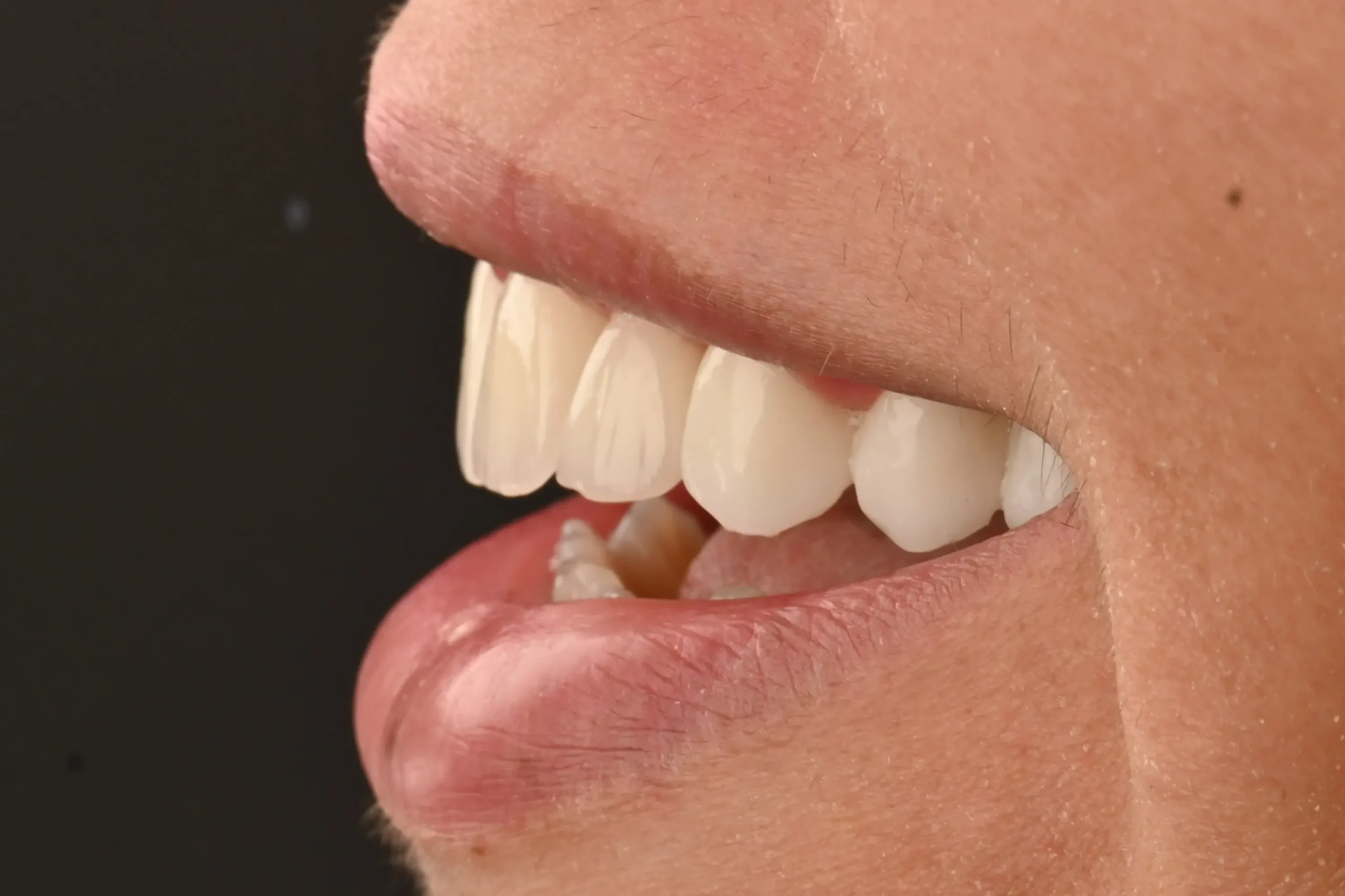 couronne dentaire maroc guide complet et prix