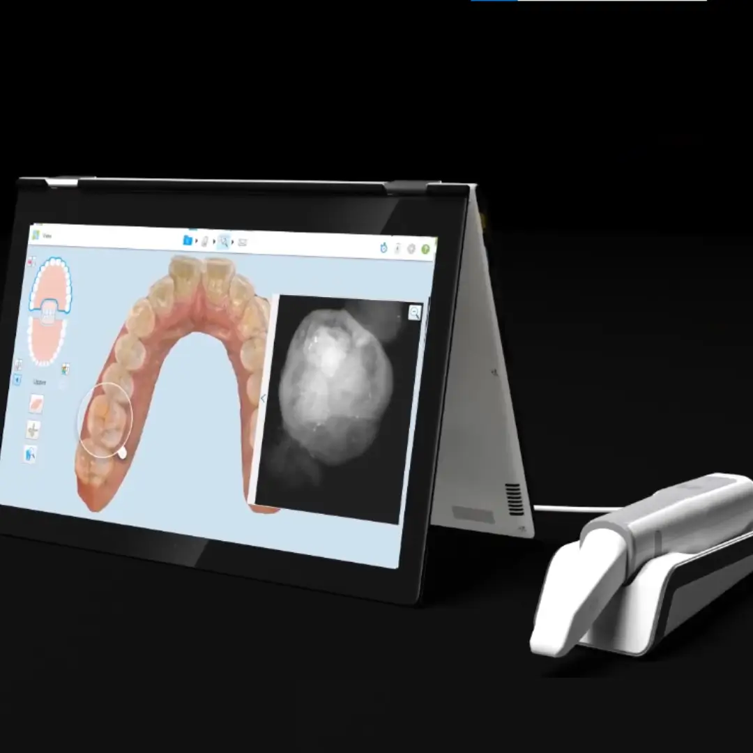 Scanner iTero Element 5D Centre Dentaire Kandil