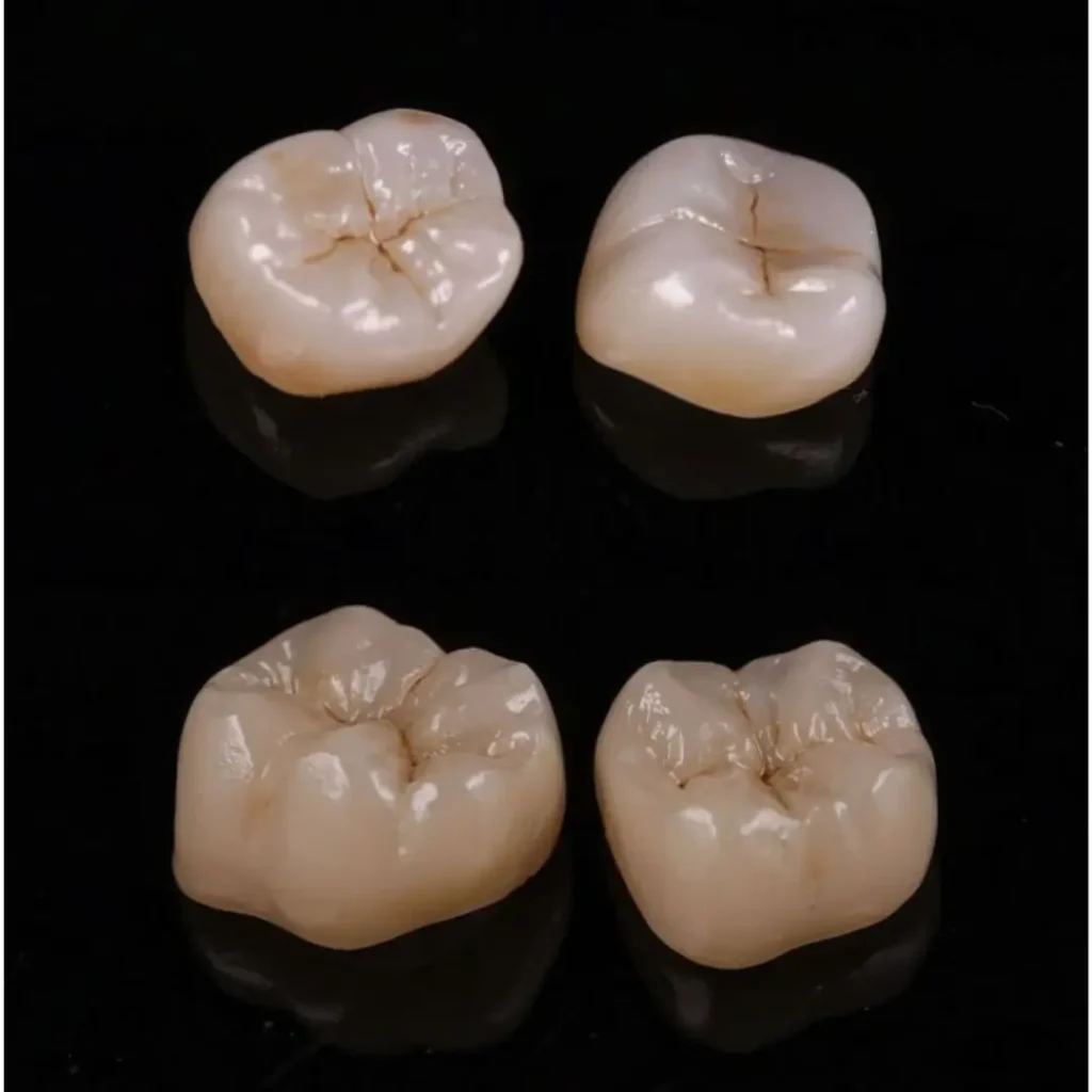 couronnes-dentaires-zircone-centre-kandil